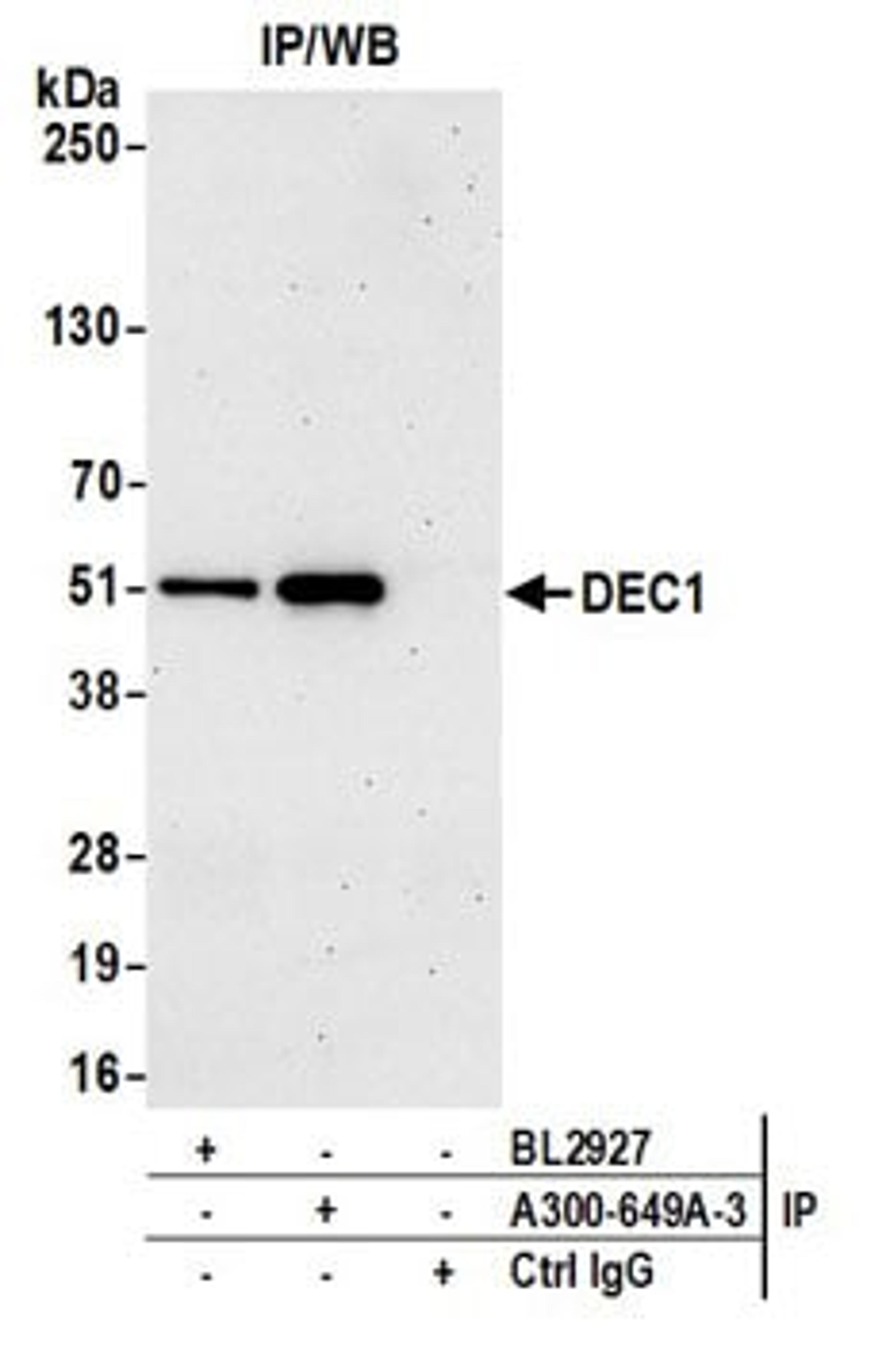 Detection of human DEC1 by western blot of immunoprecipitates.