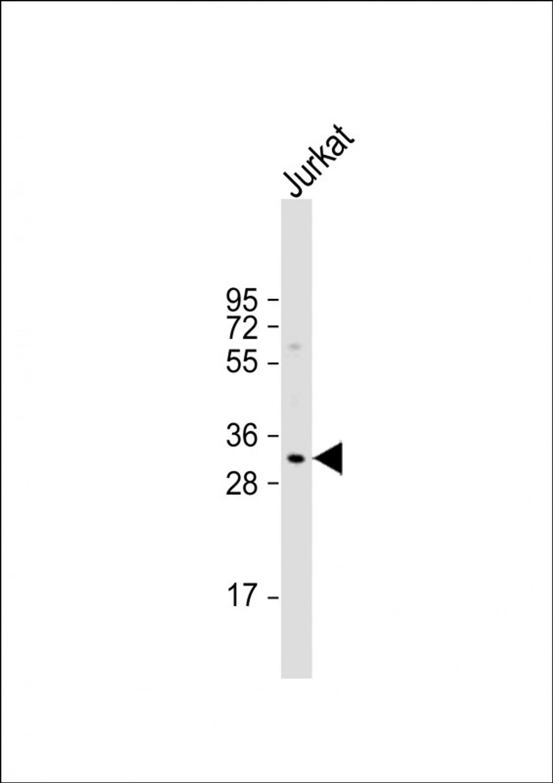 Western Blot at 1:1000 dilution + Jurkat whole cell lysate Lysates/proteins at 20 ug per lane.