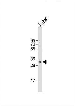 Western Blot at 1:1000 dilution + Jurkat whole cell lysate Lysates/proteins at 20 ug per lane.