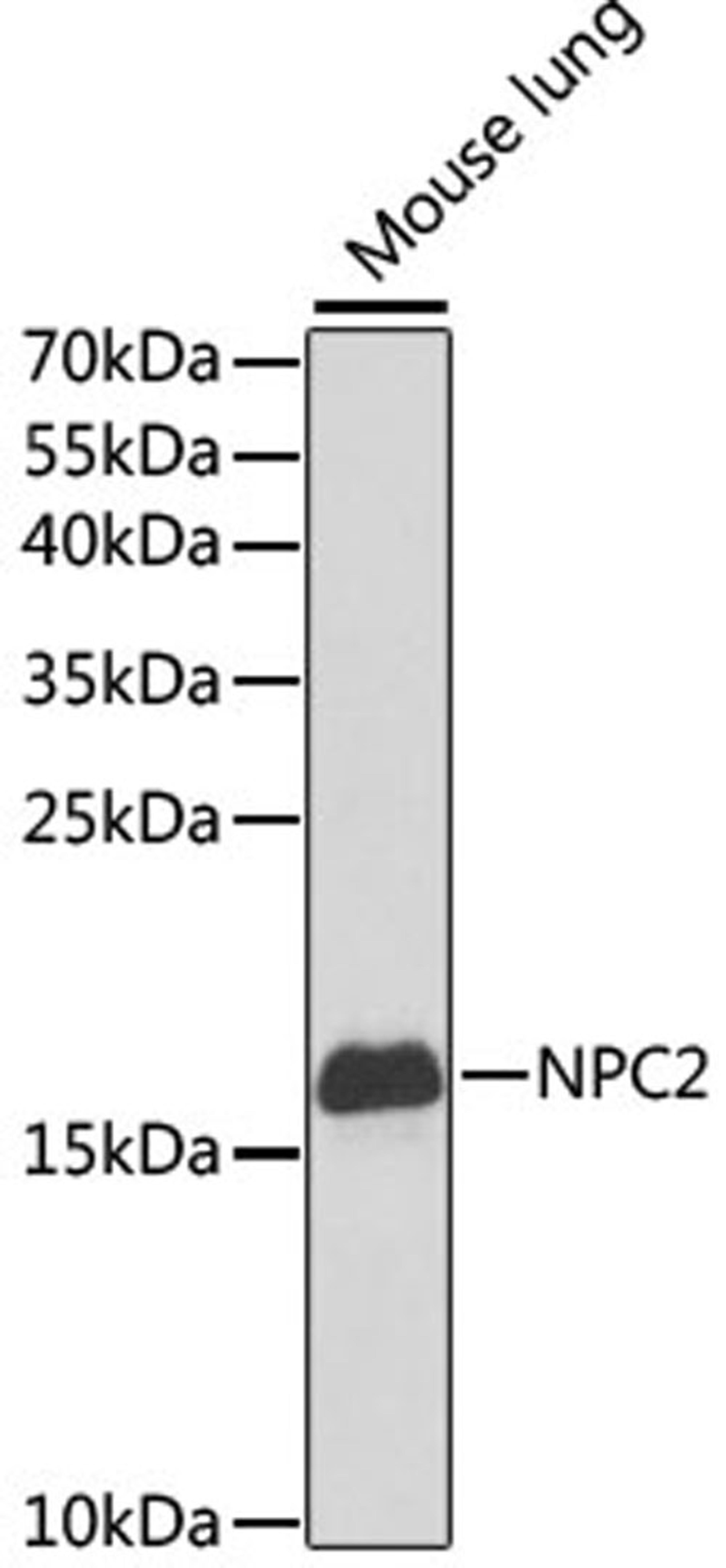 Western blot - NPC2 antibody (A5413)