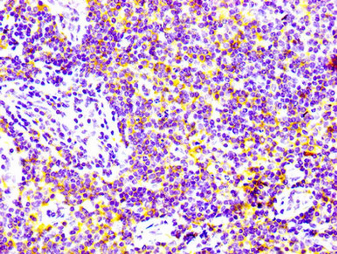 IHC image of CSB-RA004972A0HU diluted at 1:100 and staining in paraffin-embedded human lymph node tissue performed on a Leica BondTM system. After dewaxing and hydration, antigen retrieval was mediated by high pressure in a citrate buffer (pH 6.0). Section was blocked with 10% normal goat serum 30min at RT. Then primary antibody (1% BSA) was incubated at 4℃ overnight. The primary is detected by a biotinylated secondary antibody and visualized using an HRP conjugated SP system.