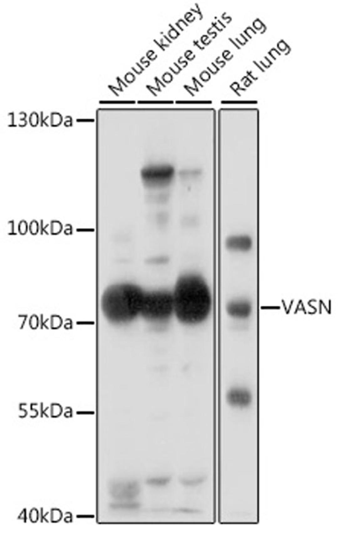 Western blot - VASN antibody (A16215)