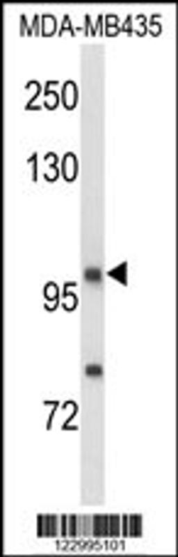 Western blot analysis of NRP1 Antibody in MDA-MB435 cell line lysates (35ug/lane)