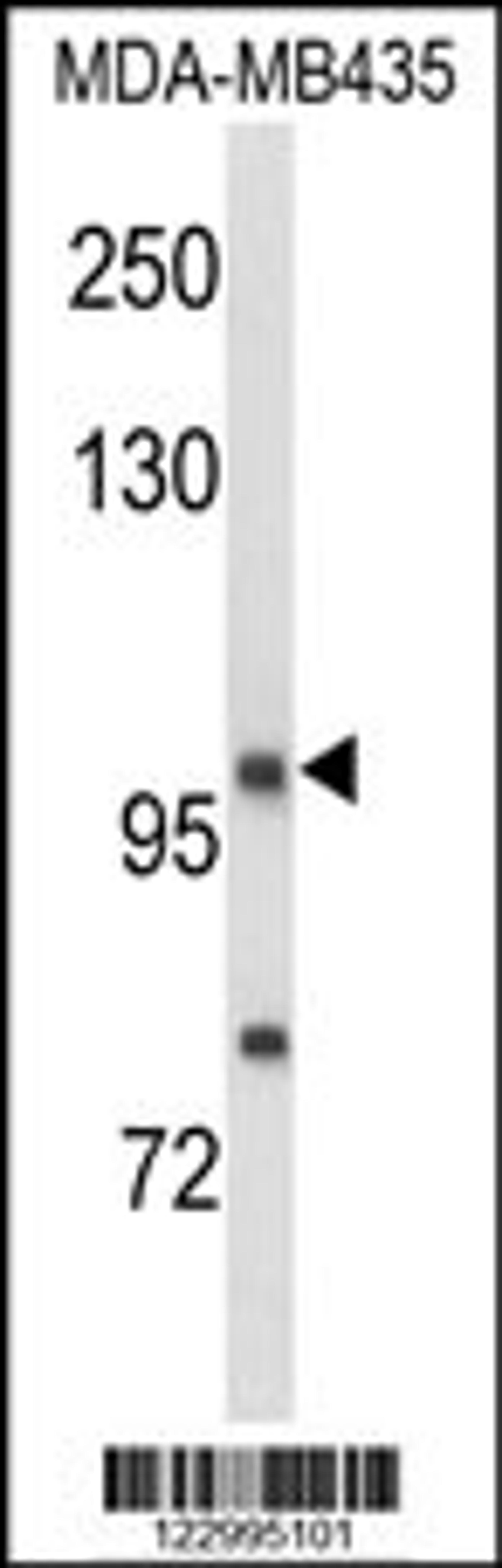 Western blot analysis of NRP1 Antibody in MDA-MB435 cell line lysates (35ug/lane)