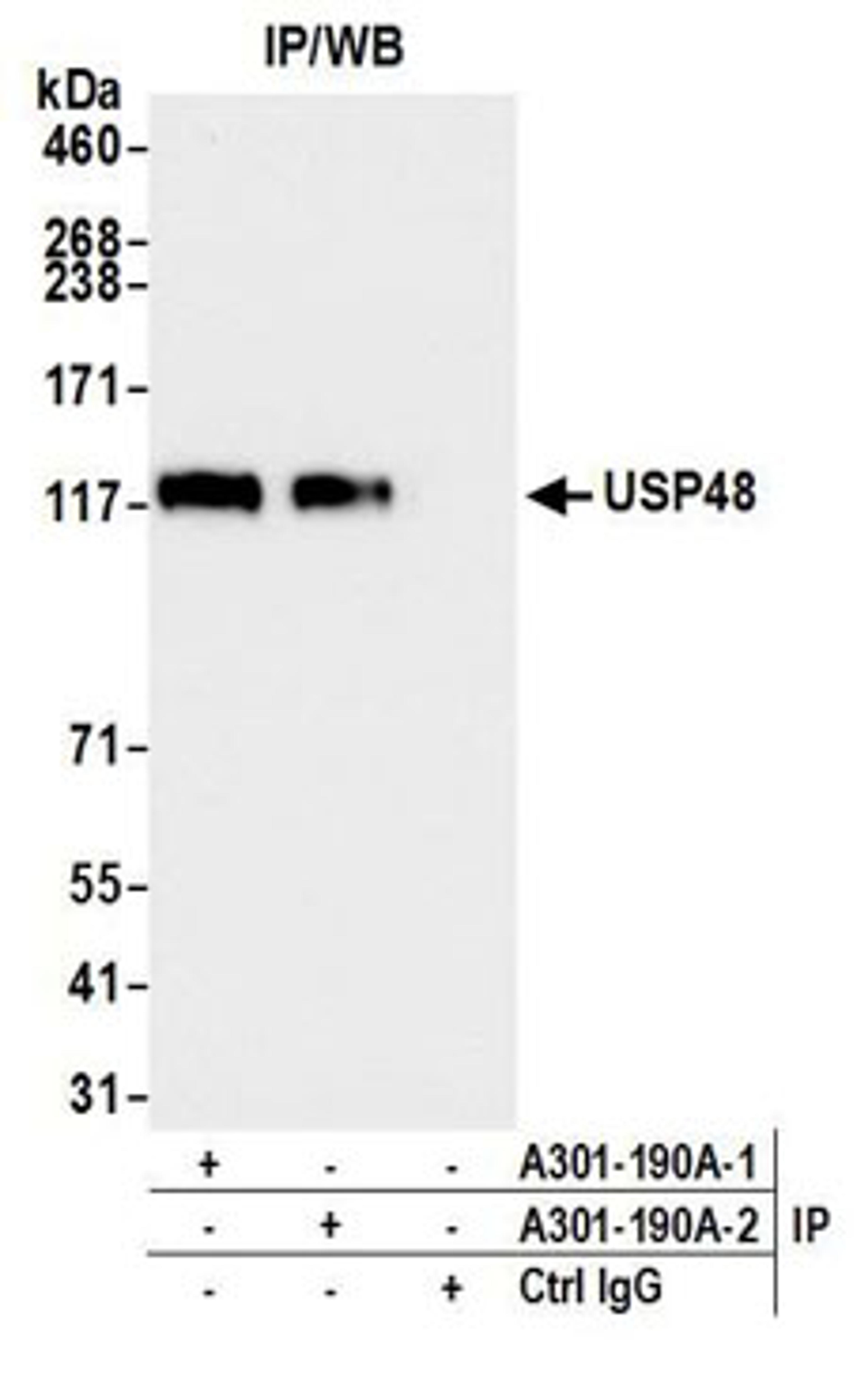 Detection of human USP48 by western blot of immunoprecipitates.