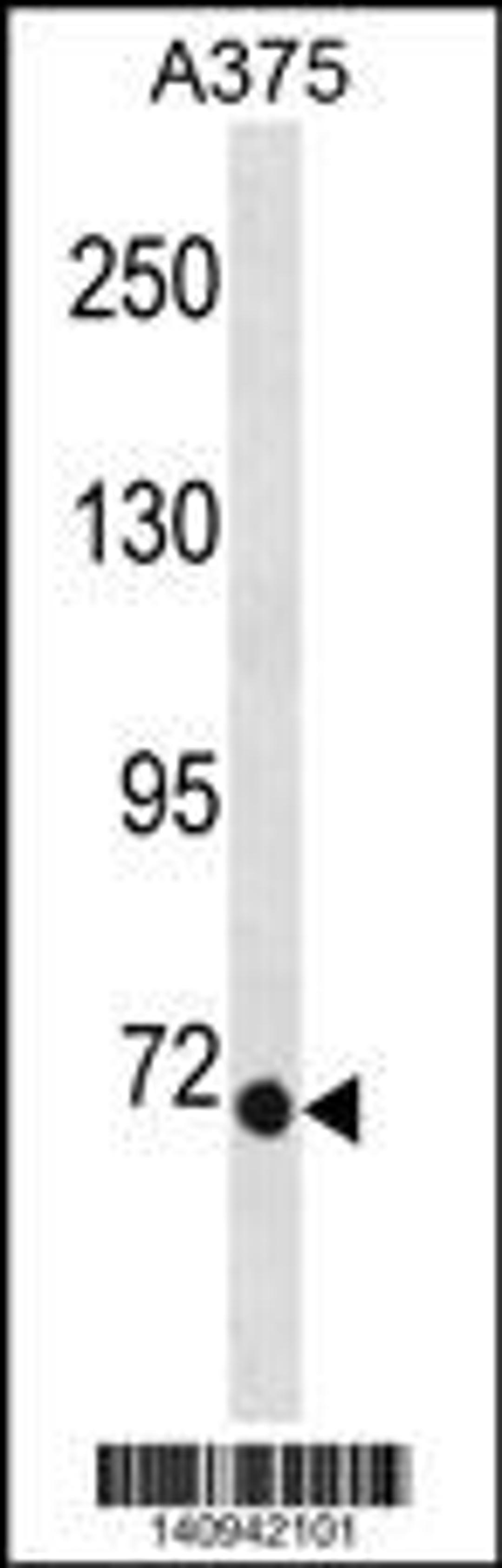 Western blot analysis in A375 cell line lysates (35ug/lane).