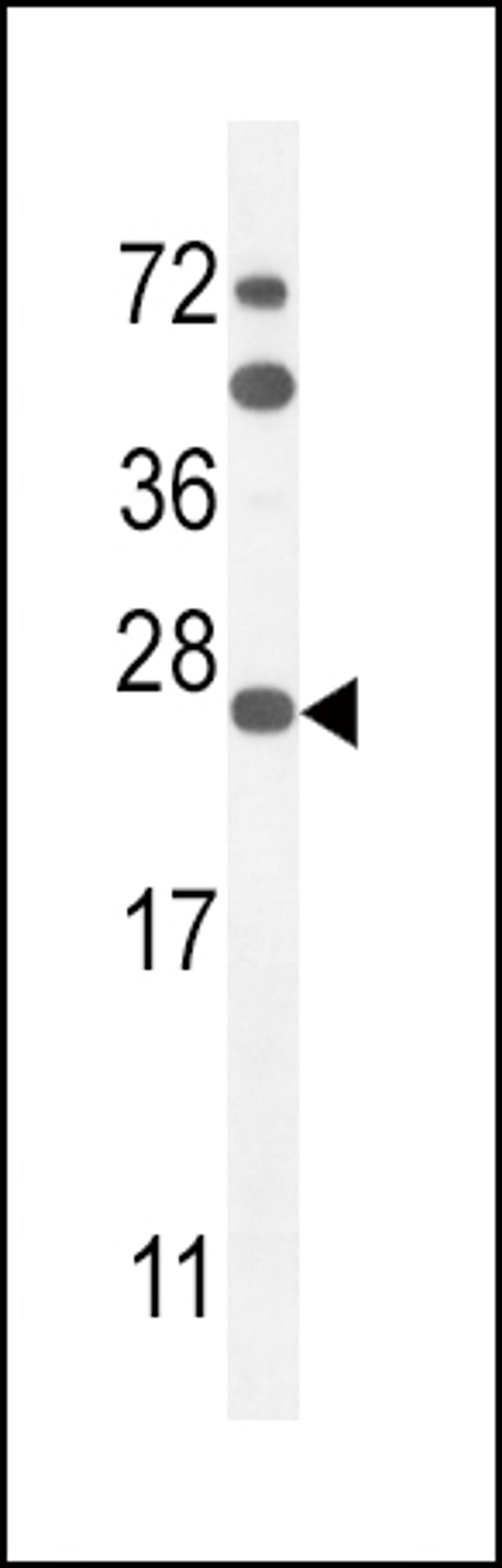 Western blot analysis in mouse Neuro-2a cell line lysates (35ug/lane).