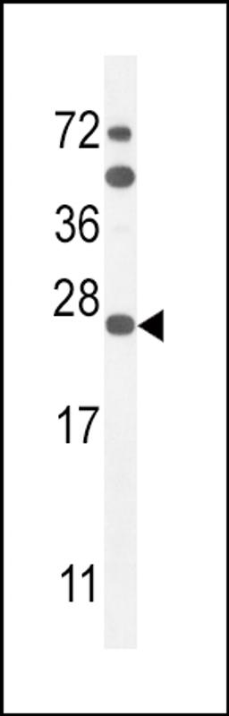 Western blot analysis in mouse Neuro-2a cell line lysates (35ug/lane).