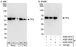 Detection of human and mouse TFG by western blot (h&m) and immunoprecipitation (h).