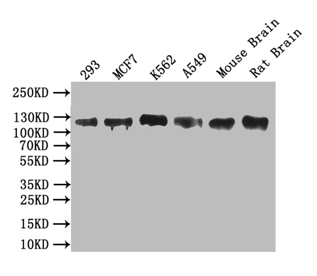 Western blot. All lanes: MCM9 antibody at 0.8ug/ml. Lane 1: Mouse brain tissue. Lane 2: 293T whole cell lysate. Secondary. Goat polyclonal to rabbit IgG at 1/10000 dilution. Predicted band size: 128, 73, 44, 85 kDa. Observed band size: 128 kDa.