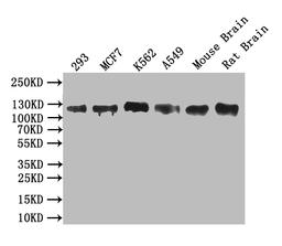 Western blot. All lanes: MCM9 antibody at 0.8ug/ml. Lane 1: Mouse brain tissue. Lane 2: 293T whole cell lysate. Secondary. Goat polyclonal to rabbit IgG at 1/10000 dilution. Predicted band size: 128, 73, 44, 85 kDa. Observed band size: 128 kDa.