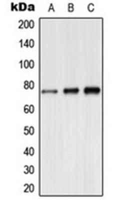 Western blot analysis of A549 (Lane 1), mouse brain (Lane 2), rat brain (Lane 3) whole cell lysates using Synapsin 1 (phospho-S9) antibody