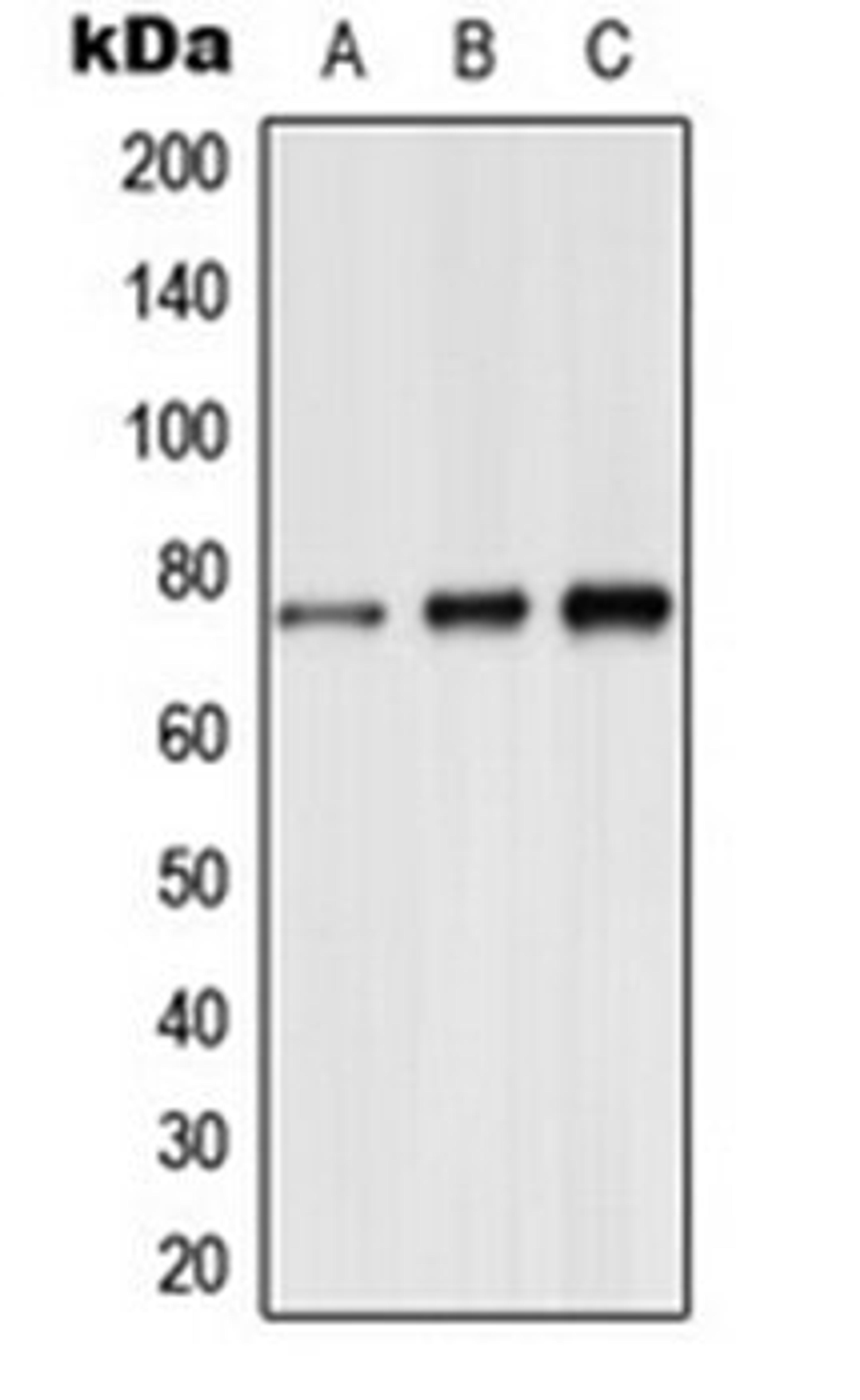 Western blot analysis of A549 (Lane 1), mouse brain (Lane 2), rat brain (Lane 3) whole cell lysates using Synapsin 1 (phospho-S9) antibody