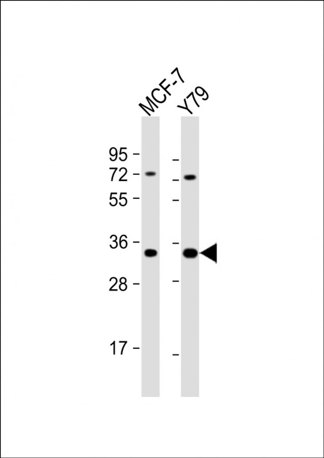 Western Blot at 1:1000 dilution Lane 1: MCF-7 whole cell lysate Lane 2: Y79 whole cell lysate Lysates/proteins at 20 ug per lane.