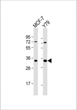 Western Blot at 1:1000 dilution Lane 1: MCF-7 whole cell lysate Lane 2: Y79 whole cell lysate Lysates/proteins at 20 ug per lane.