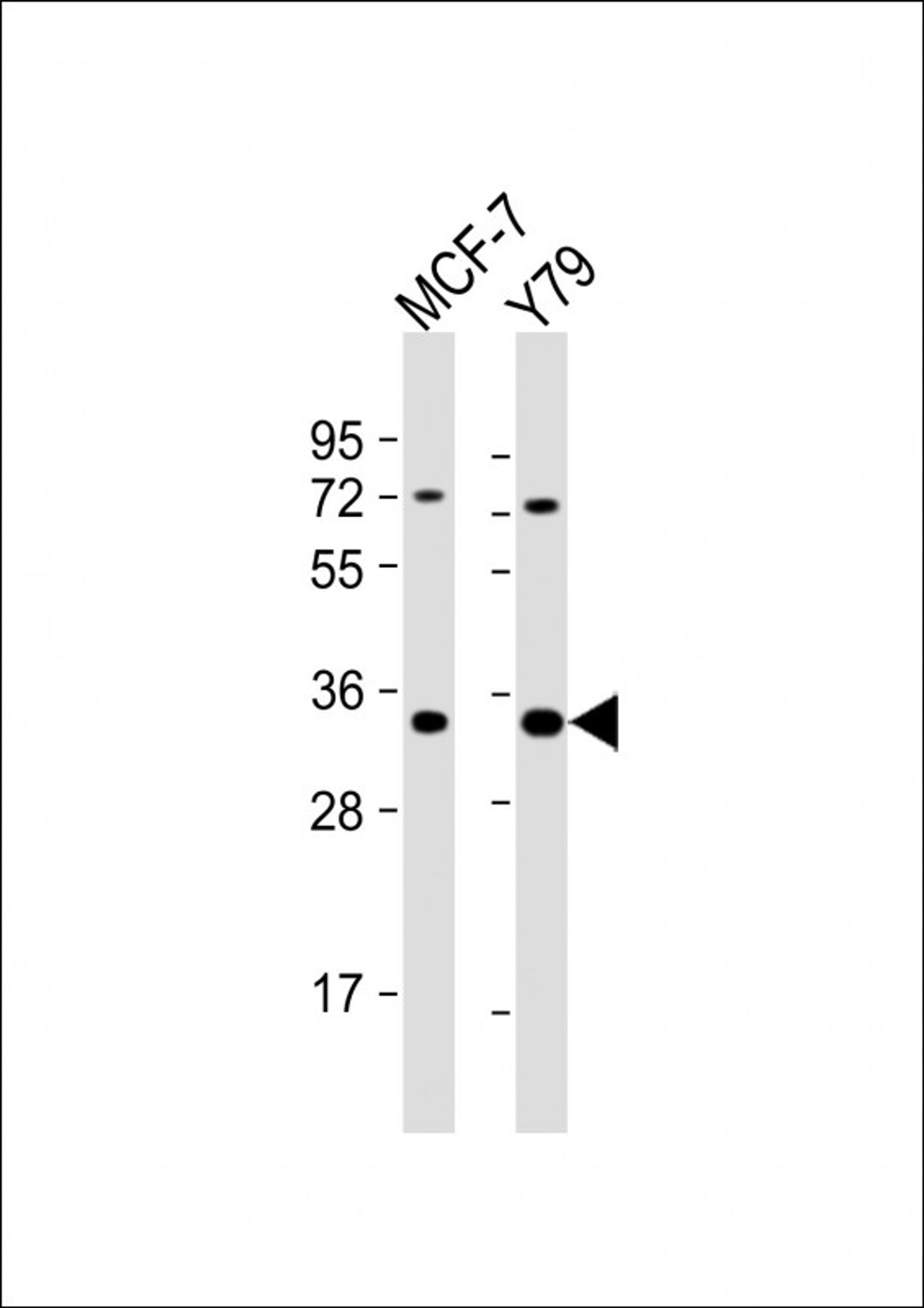 Western Blot at 1:1000 dilution Lane 1: MCF-7 whole cell lysate Lane 2: Y79 whole cell lysate Lysates/proteins at 20 ug per lane.