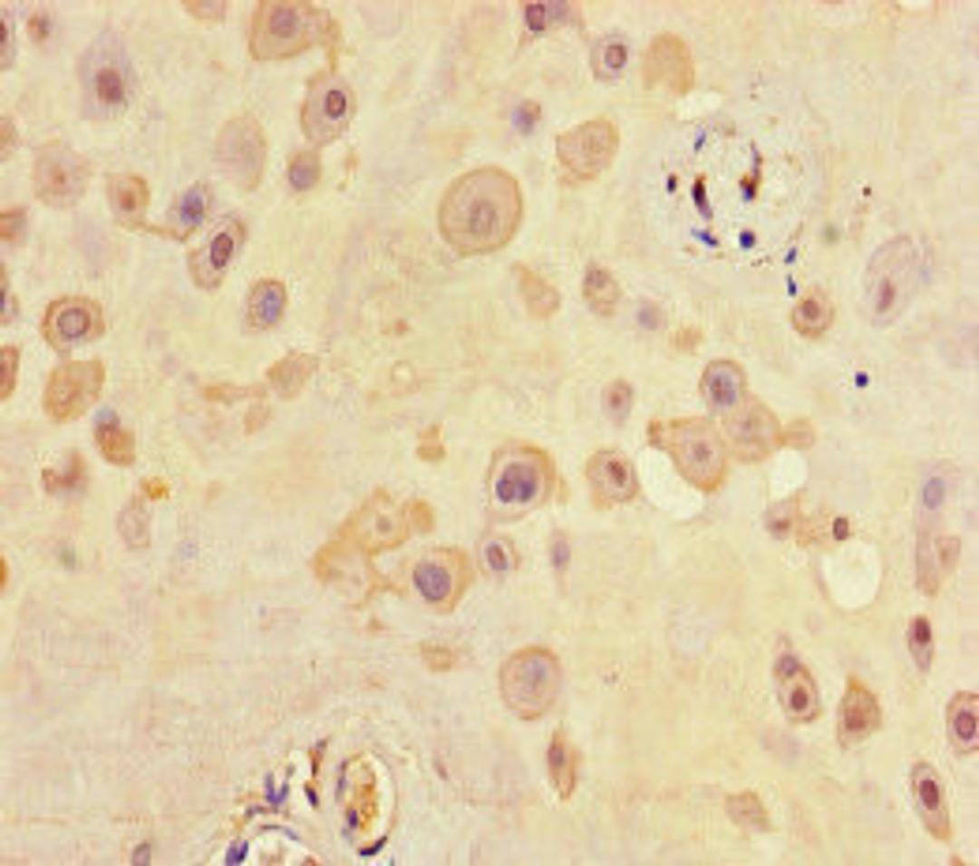 Immunohistochemistry of paraffin-embedded human placenta tissue using CSB-PA020808LA01HU at dilution of 1:100