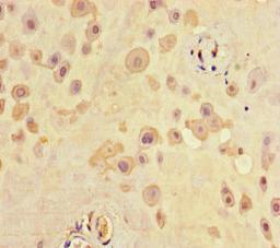 Immunohistochemistry of paraffin-embedded human placenta tissue using CSB-PA020808LA01HU at dilution of 1:100
