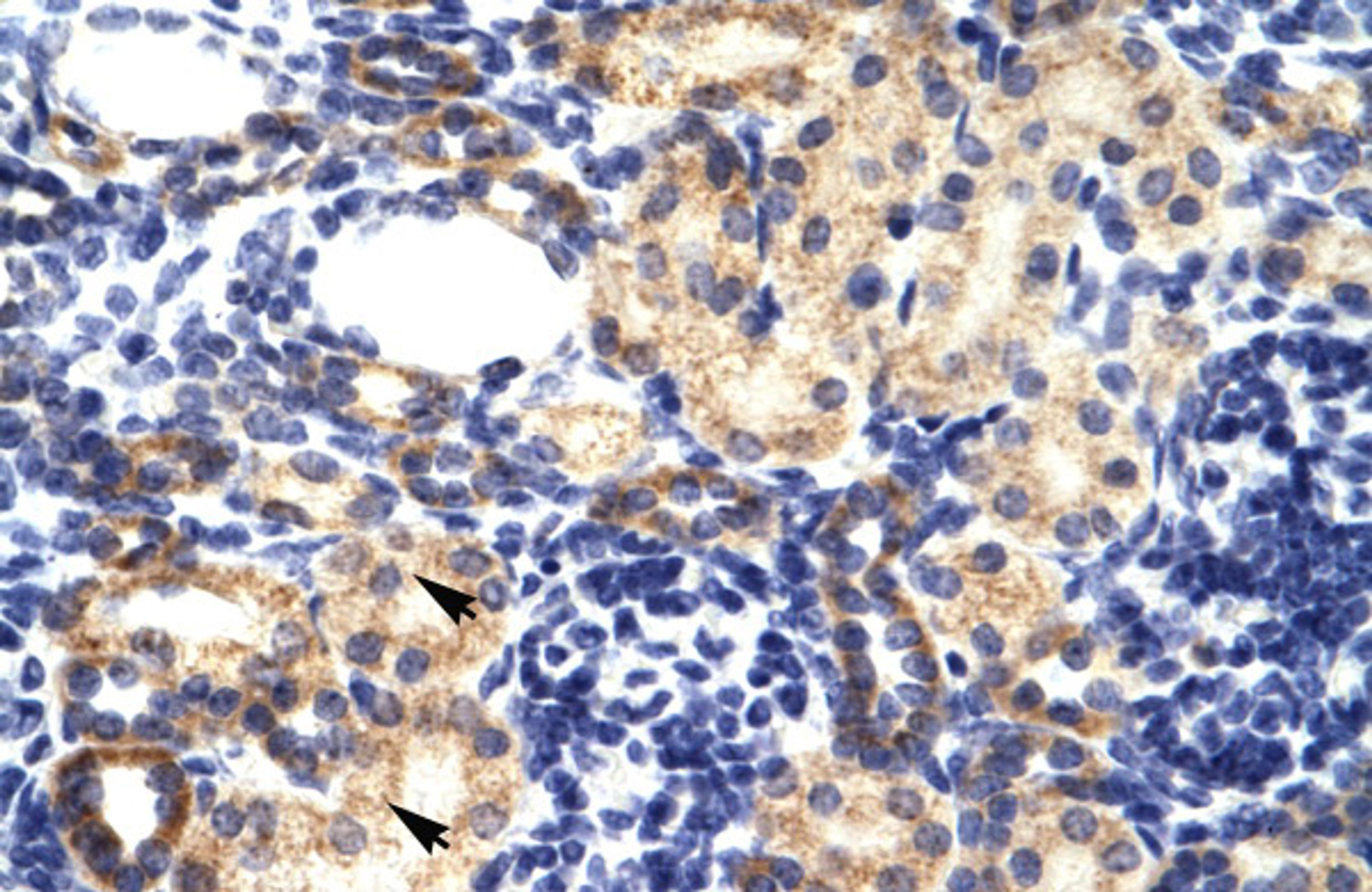 Antibody used in IHC on Human kidney.