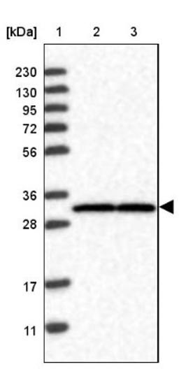 Western Blot: UBE2CBP Antibody [NBP1-86757] - Lane 1: Marker [kDa] 230, 130, 95, 72, 56, 36, 28, 17, 11<br/>Lane 2: Human cell line RT-4<br/>Lane 3: Human cell line U-251MG sp