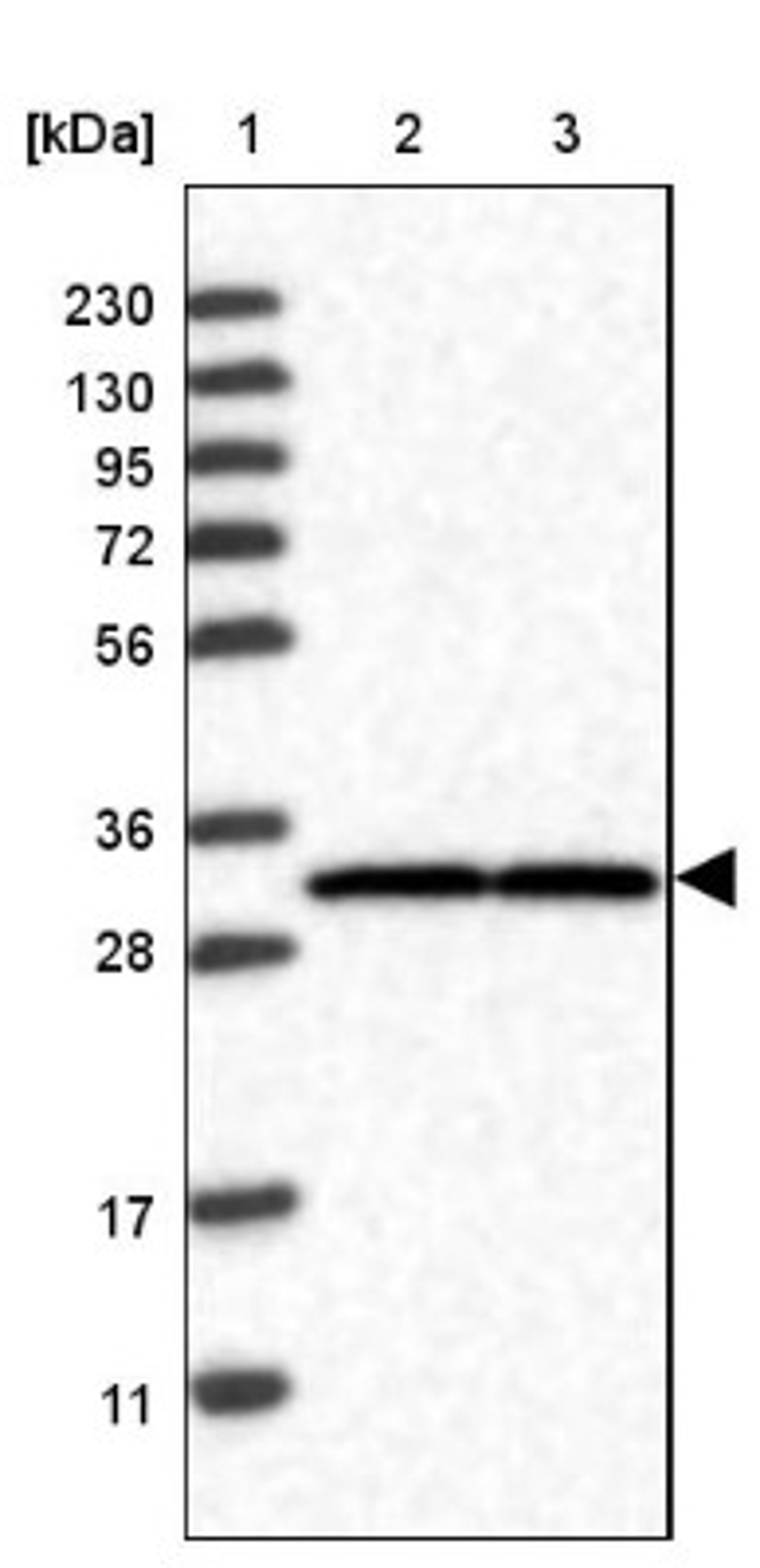 Western Blot: UBE2CBP Antibody [NBP1-86757] - Lane 1: Marker [kDa] 230, 130, 95, 72, 56, 36, 28, 17, 11<br/>Lane 2: Human cell line RT-4<br/>Lane 3: Human cell line U-251MG sp