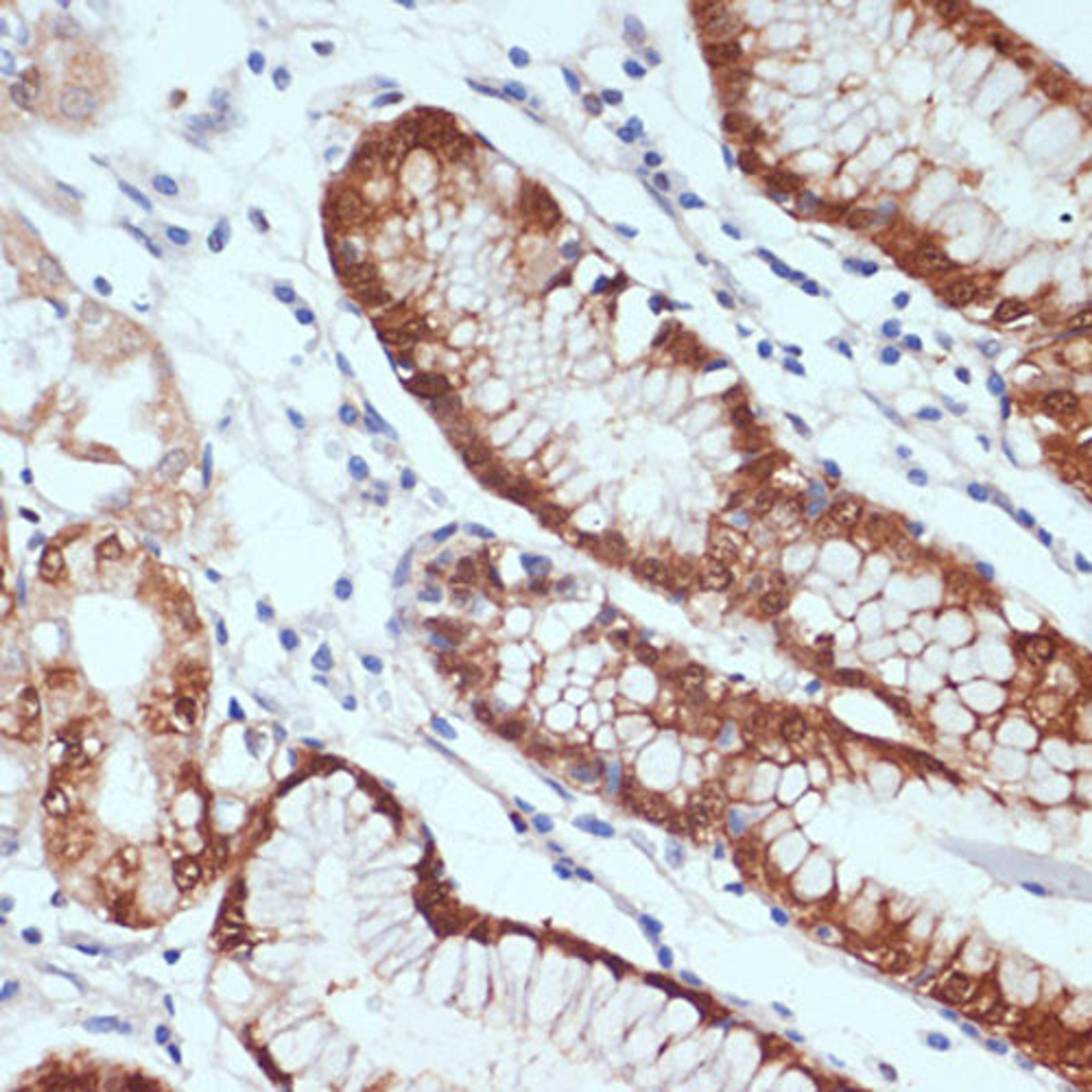 Immunohistochemistry - CXCL12 antibody (A1325)