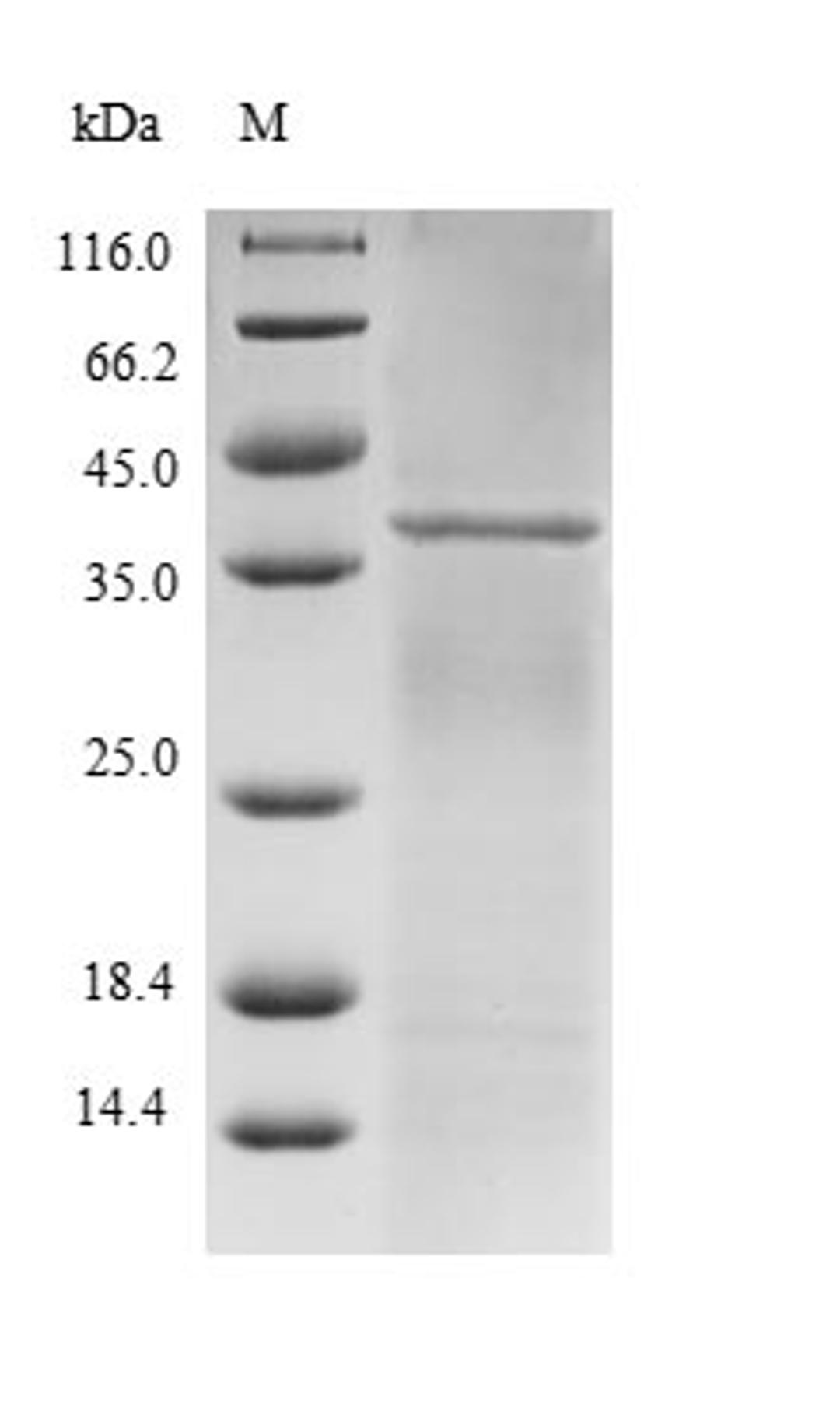 (Tris-Glycine gel) Discontinuous SDS-PAGE (reduced) with 5% enrichment gel and 15% separation gel.