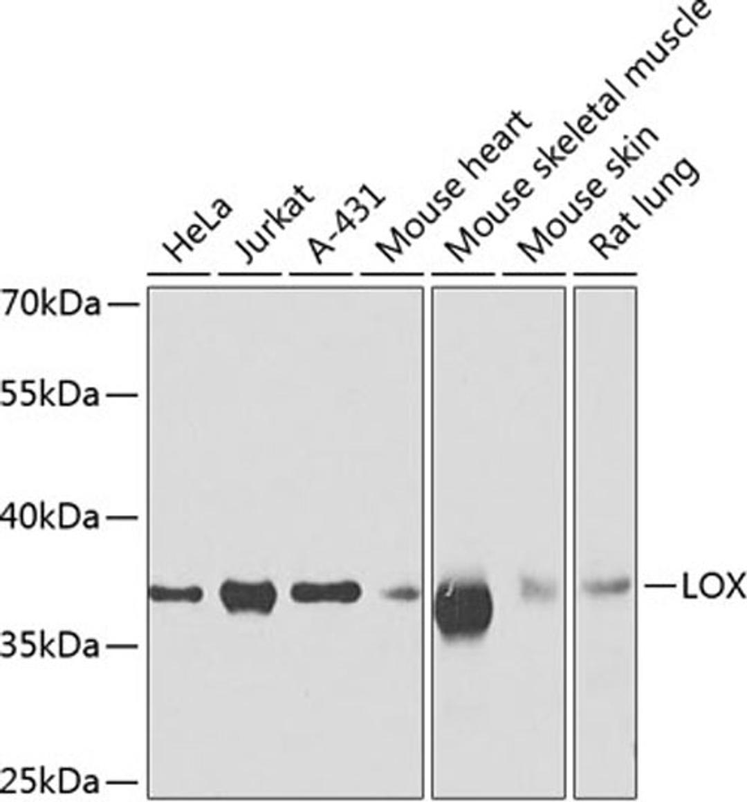 Western blot - LOX antibody (A7698)