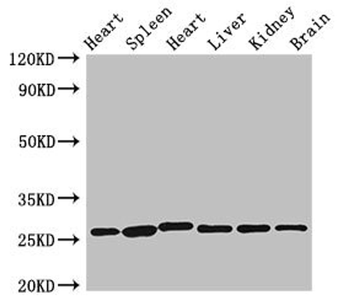 Western Blot. Positive WB detected in: Rat heart tissue, Rat spleen tissue, Mouse heart tissue, Mouse liver tissue, Mouse kidney tissue, Mouse brain tissue. All lanes: VEGFB antibody at 3.5µg/ml. Secondary. Goat polyclonal to rabbit IgG at 1/50000 dilution. Predicted band size: 22 kDa. Observed band size: 28 kDa