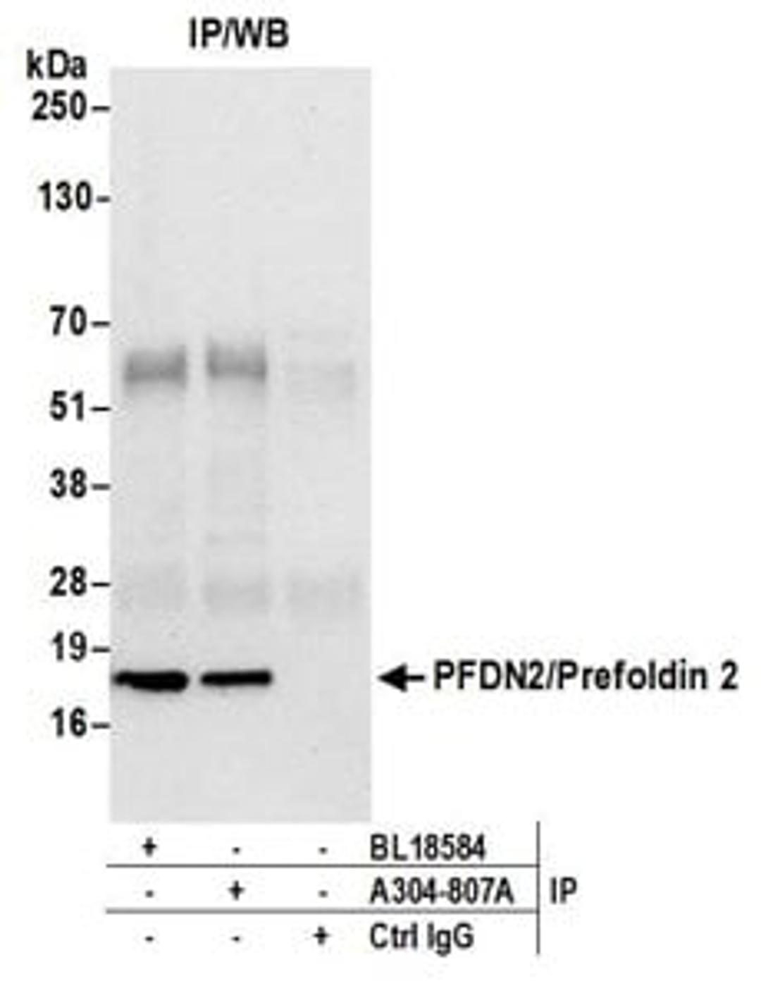 Detection of human PFDN2/Prefoldin 2 by western blot of immunoprecipitates.