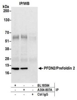 Detection of human PFDN2/Prefoldin 2 by western blot of immunoprecipitates.