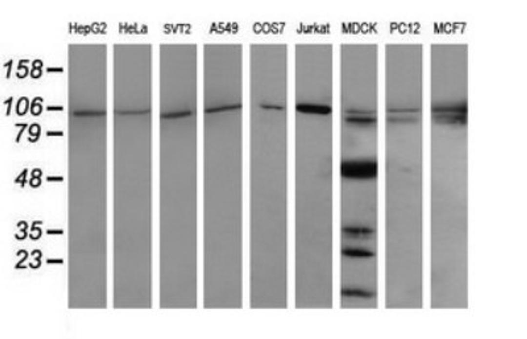 Western Blot: PIK3R5 Antibody (4G9) [NBP2-46413] - Analysis of extracts (35ug) from 9 different cell lines (HepG2: human; HeLa: human; SVT2: mouse; A549: human; COS7: monkey; Jurkat: human; MDCK: canine; PC12: rat; MCF7: human).