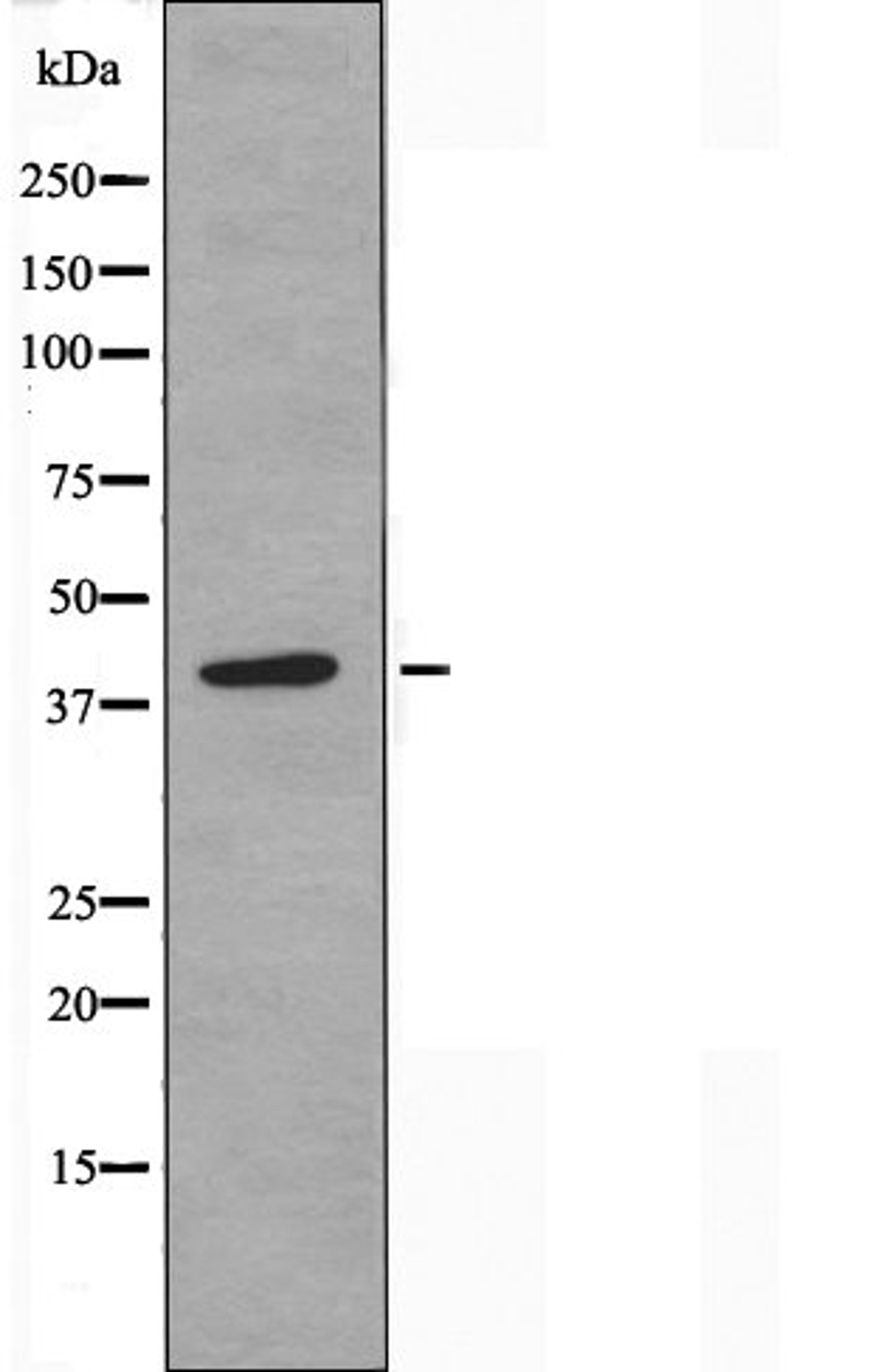 Western blot analysis of K562 cells using PDIK1L antibody