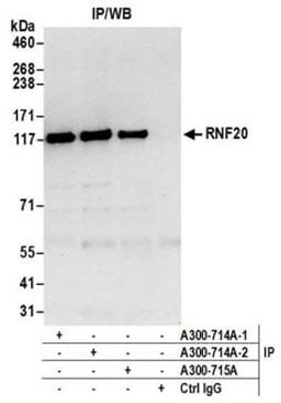 Detection of human RNF20 by western blot of immunoprecipitates.