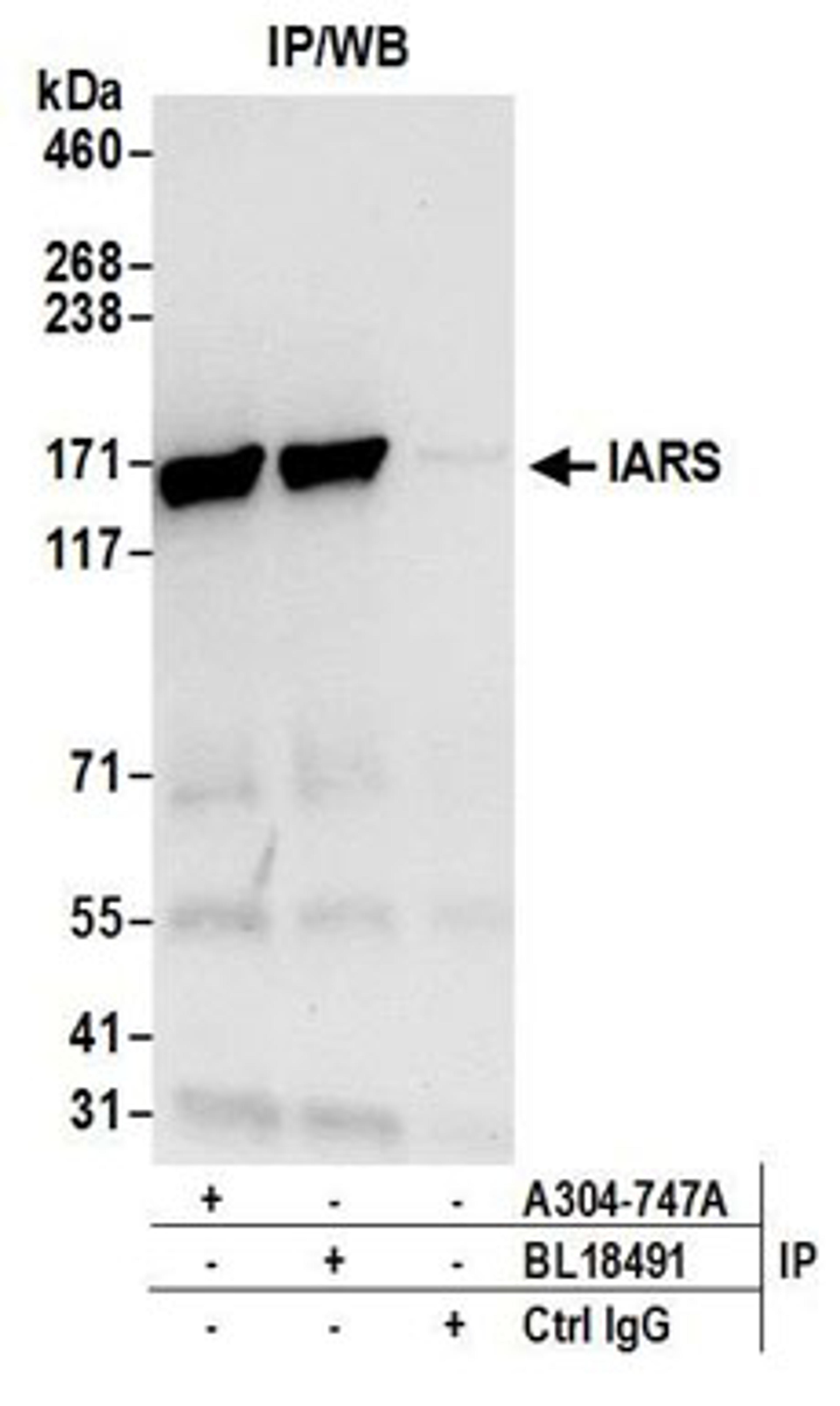 Detection of human IARS by western blot of immunoprecipitates.