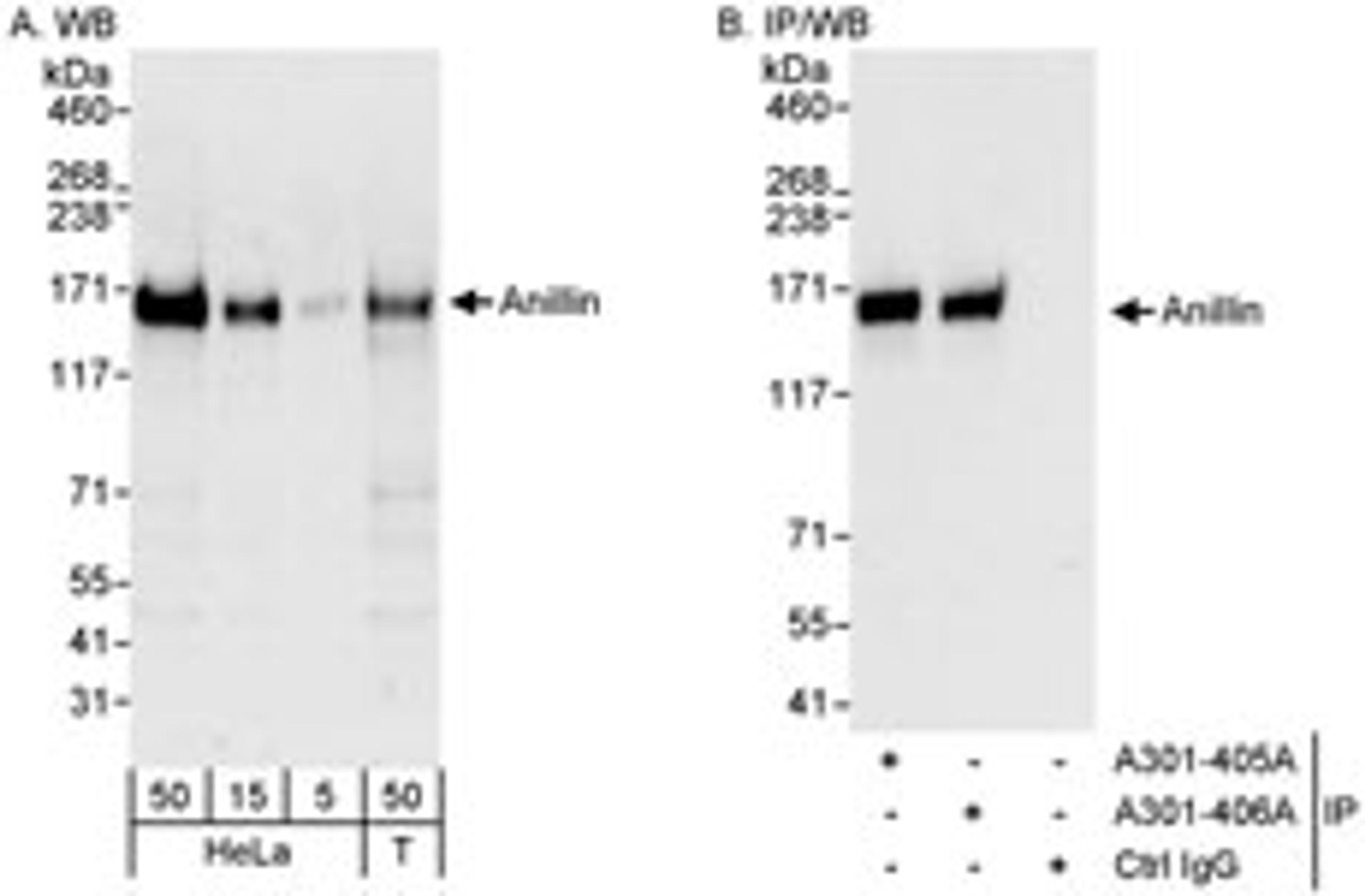 Detection of human Anillin by western blot and immunoprecipitation.