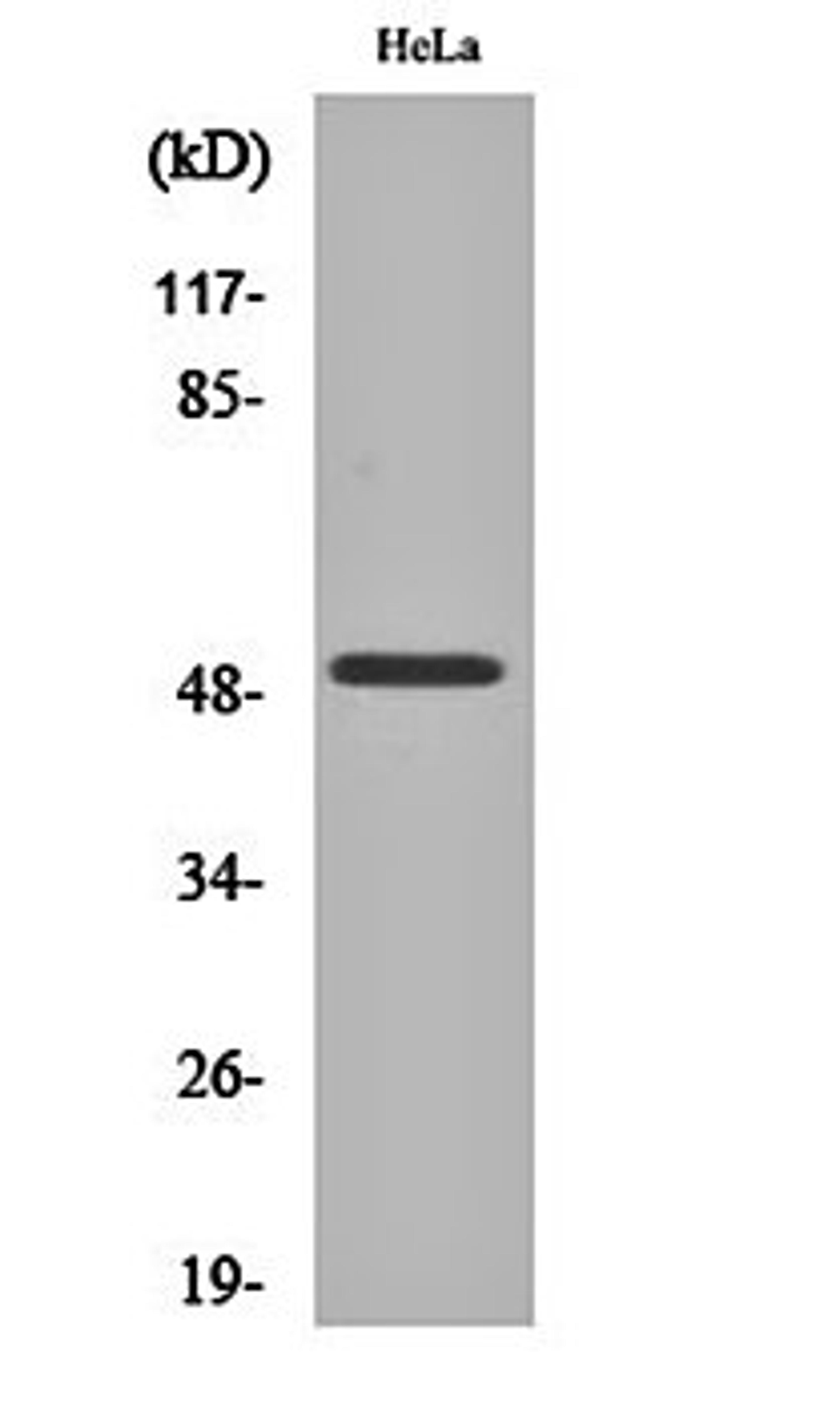 Western blot analysis of Hela cell lysates using Egr-2 antibody