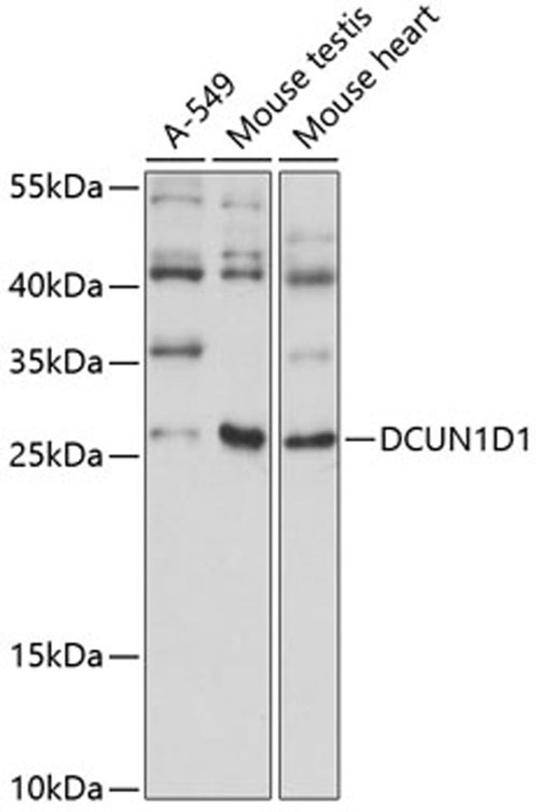 Western blot - DCUN1D1 antibody (A14587)