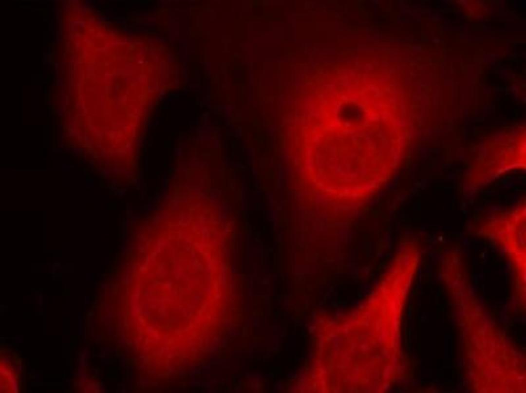 Immunocytochemistry/Immunofluorescence: eIF2A [p Ser49] Antibody [NBP1-04963] - Staining of methanol-fixed Hela cells using eIF2a (phospho-Ser49) antibody