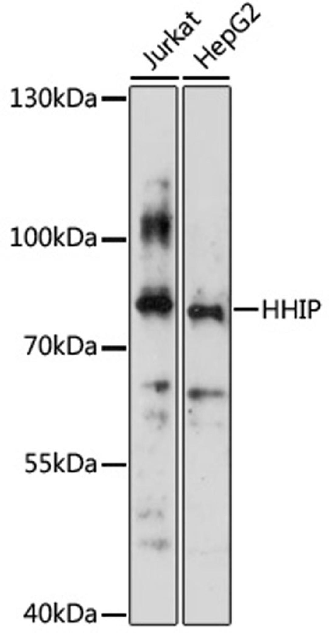 Western blot - HHIP antibody (A3260)