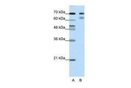 Antibody used in WB on Human HepG2 cells at 1 ug/ml.