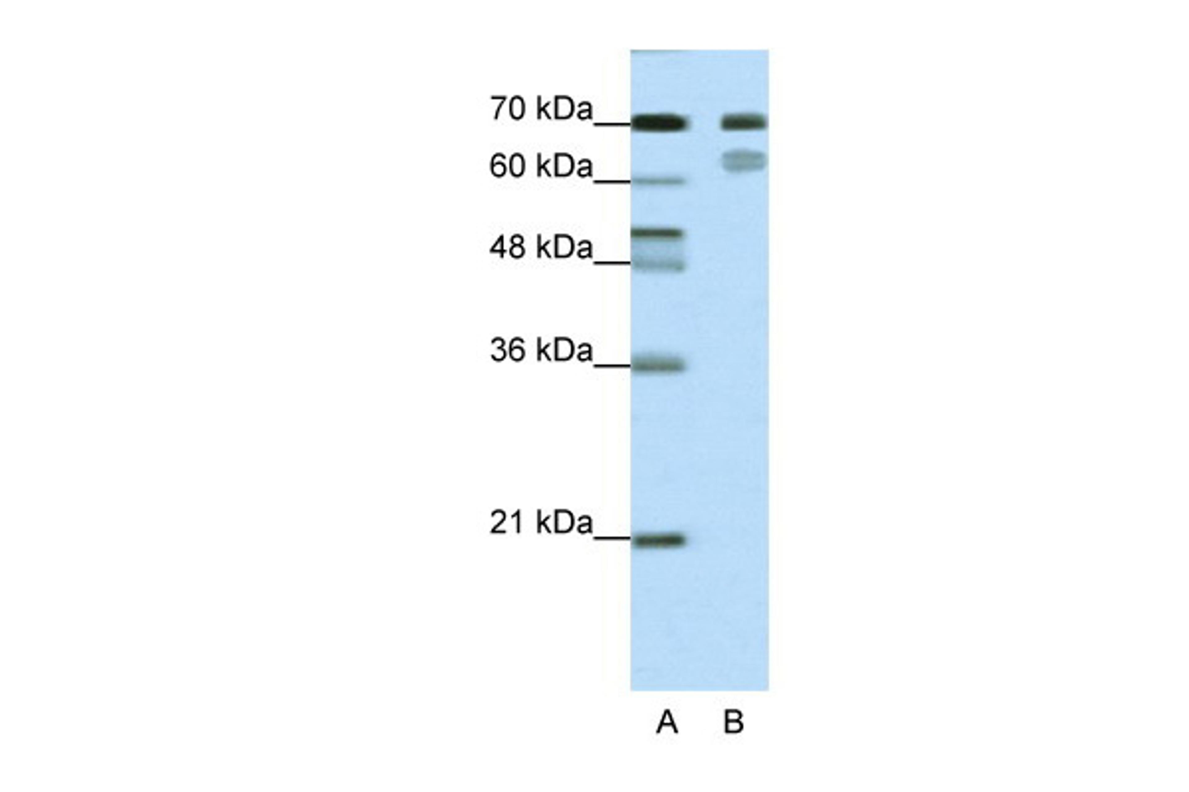 Antibody used in WB on Human HepG2 cells at 1 ug/ml.