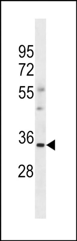 Western blot analysis in human Uterus tissue lysates (35ug/lane).