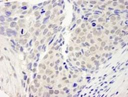 Detection of human ZNF592 by immunohistochemistry.