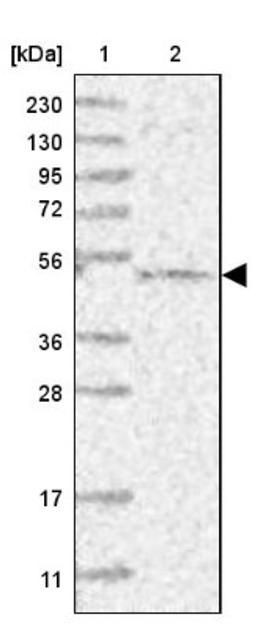 Western Blot: CEP70 Antibody [NBP1-88593] - Lane 1: Marker [kDa] 230, 130, 95, 72, 56, 36, 28, 17, 11<br/>Lane 2: Human cell line RT-4