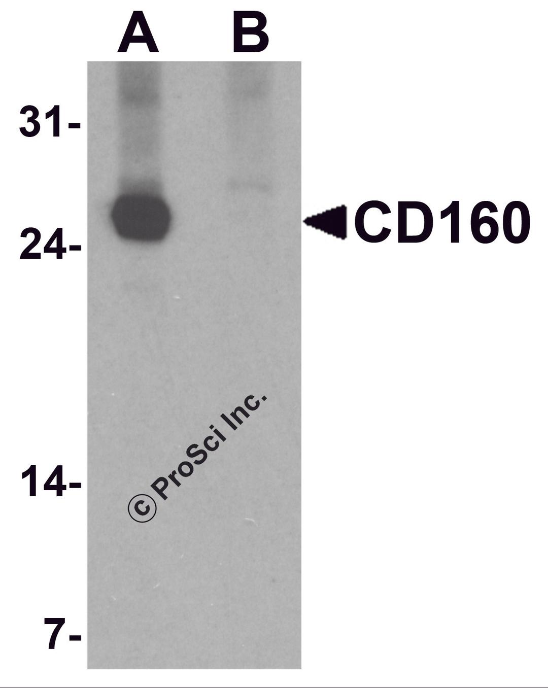 Western blot analysis of CD160 in K562 cell lysate with CD160 antibody at 1 μg/ml in (A) the absence and (B) the presence of blocking peptide.