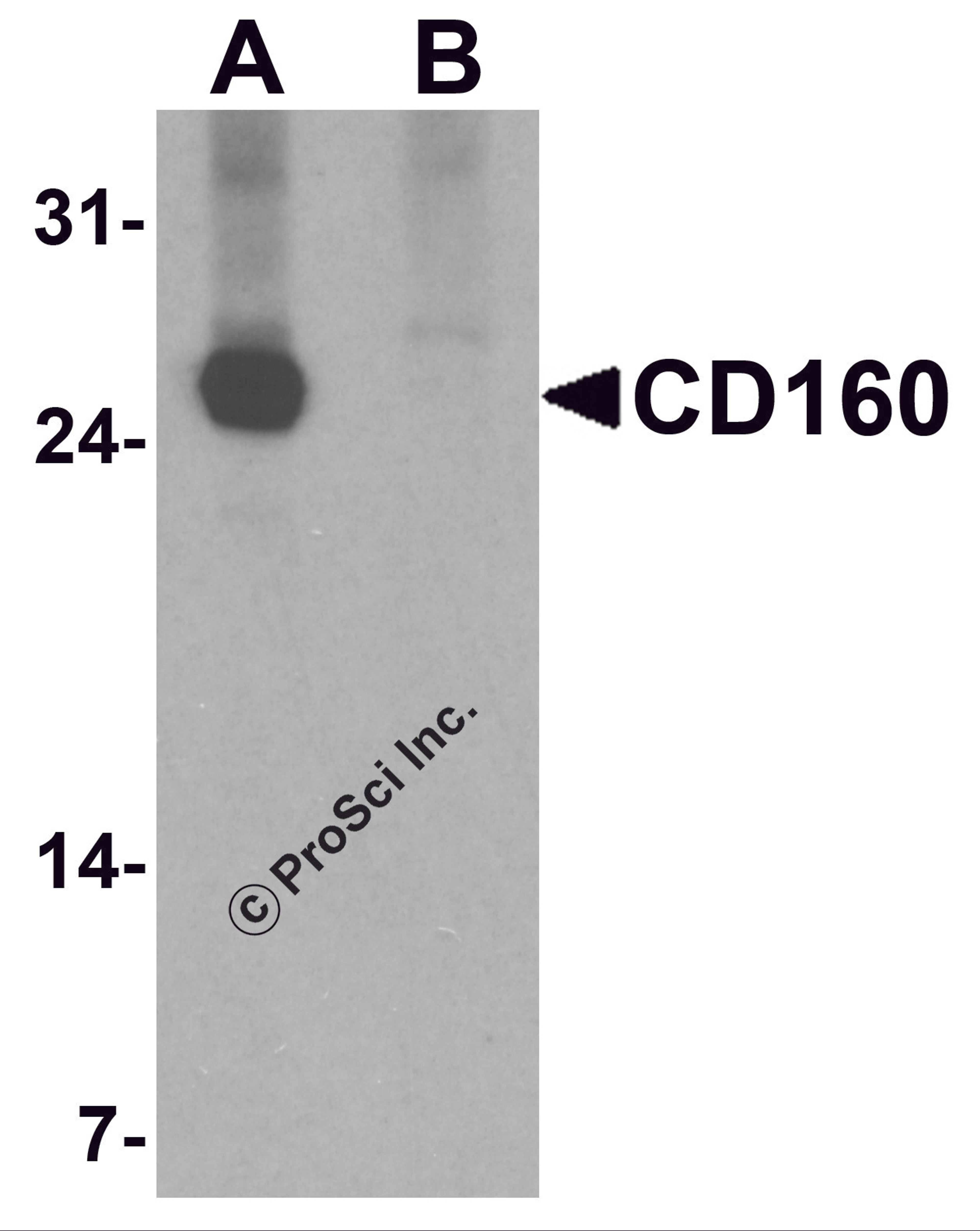 Western blot analysis of CD160 in K562 cell lysate with CD160 antibody at 1 μg/ml in (A) the absence and (B) the presence of blocking peptide.