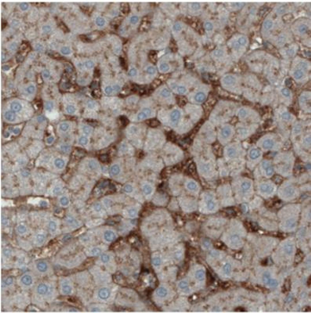 Immunohistochemistry: ITIH4 Antibody (CL1858) [NBP2-34492] - Immunohistochemical staining of human liver shows immunoreactivity in sinusoids.