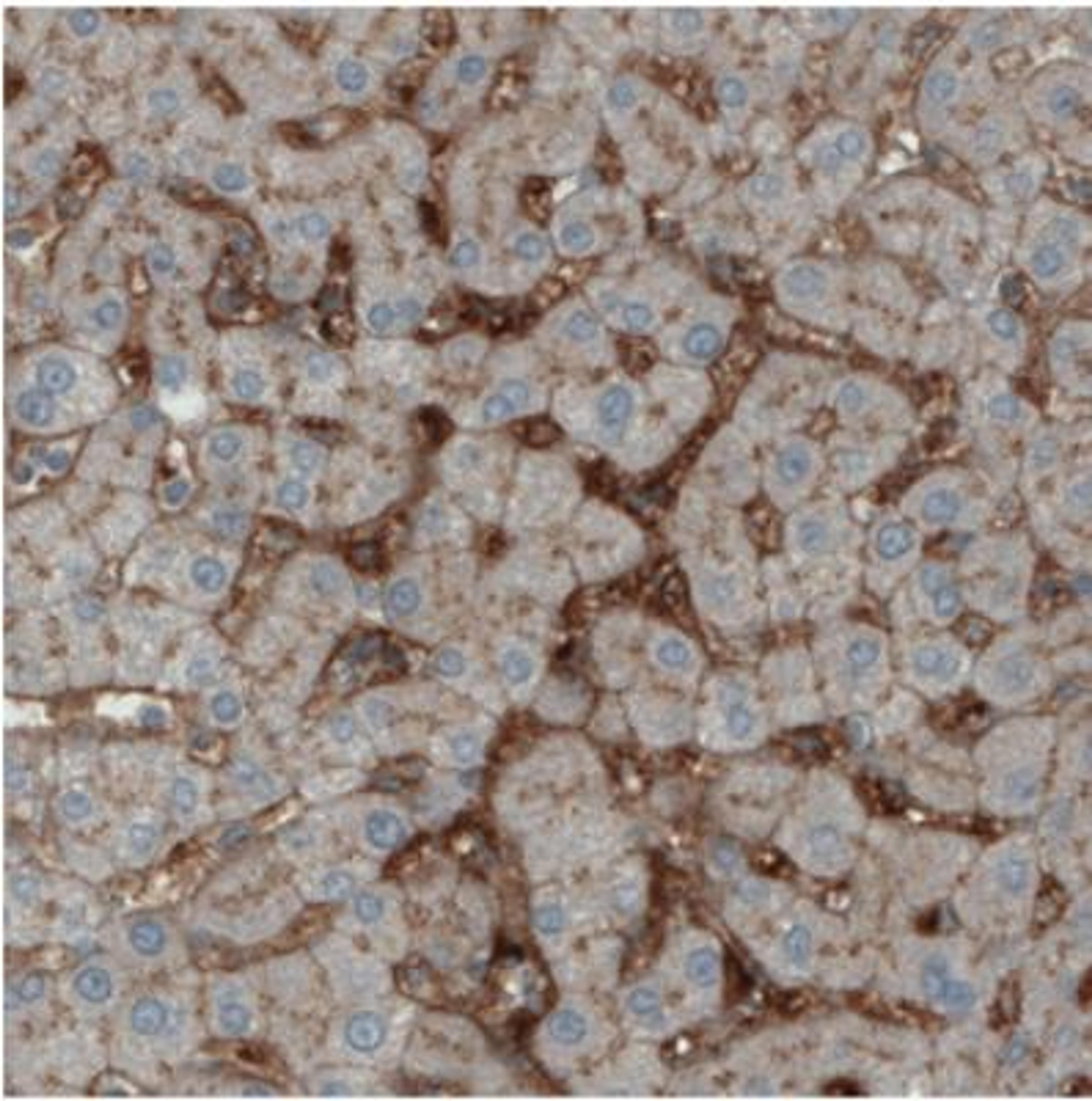 Immunohistochemistry: ITIH4 Antibody (CL1858) [NBP2-34492] - Immunohistochemical staining of human liver shows immunoreactivity in sinusoids.