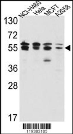 Western blot analysis of IMPDH2 Antibody in NCI-H460,Hela,MCF7,A2058 cell line lysates(35ug/lane)